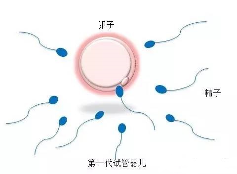 包生男孩助孕机构代生供卵医院生殖中心